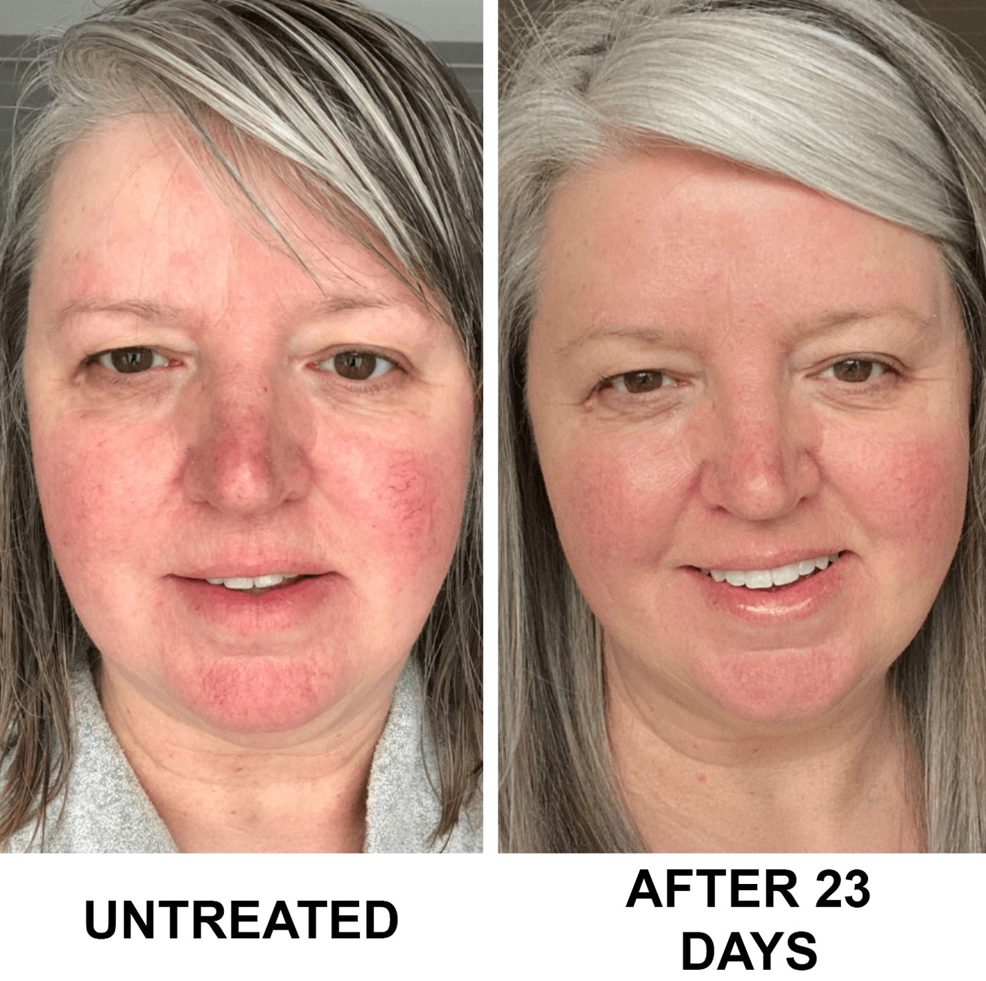 Complete Renewal & Relief Serum