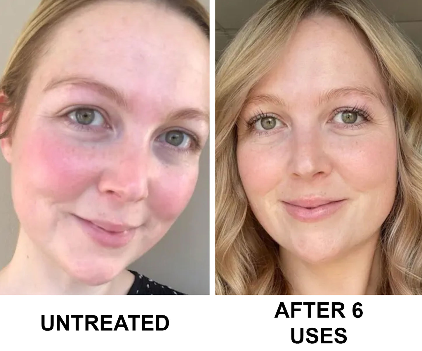 Complete Renewal & Relief Serum