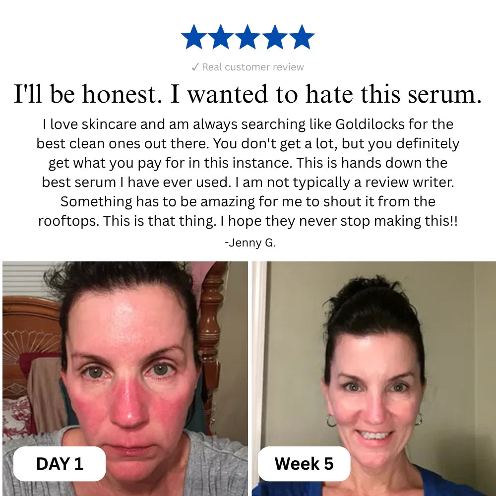 🎃 Complete Renewal & Relief Serum Halloween BOGO 🎃