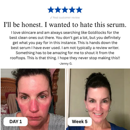 🎃 Complete Renewal & Relief Serum Halloween BOGO 🎃