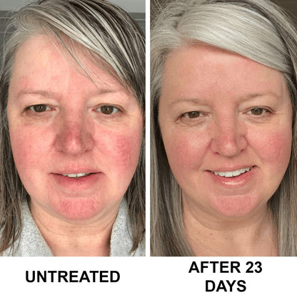 Complete Renewal & Relief Serum